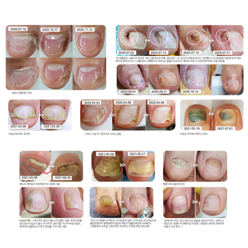 ANTIFUNG Nail Repair Serum